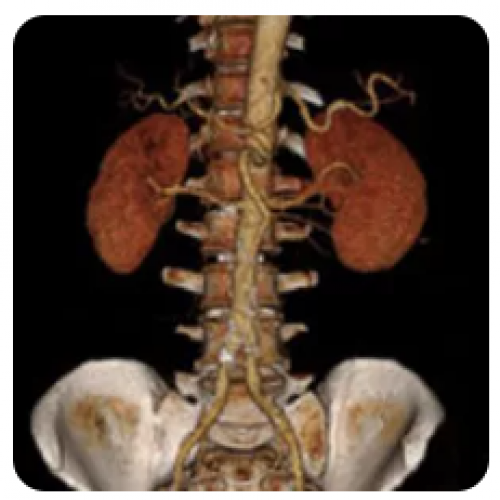 Curso de AngioTomografia