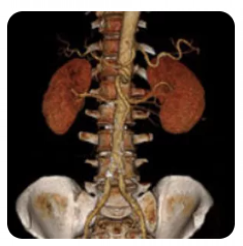 Curso de AngioTomografia