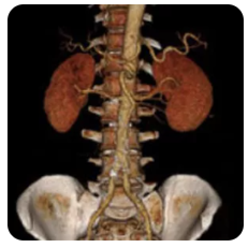 Curso de AngioTomografia
