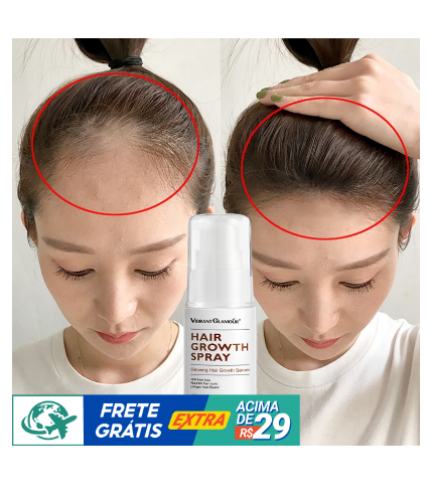 Essència De Crescimento Capilar Criador De Cabelo Tratamento Anti-Queda De Cabelo Para Homem E Mulheres 30ml